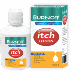 Uppal Itch Lotion (40ml)